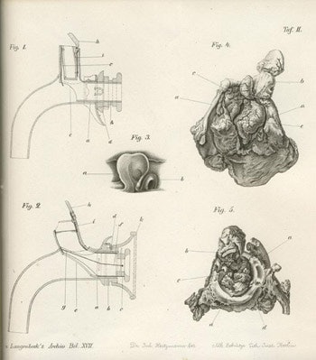 02_Dr-Fritsch_ukmss-2842-f0002