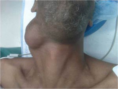 Patients evaluated at Grady Health System, which provides care for indigent individuals in the metropolitan Atlanta area.