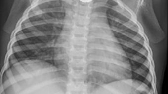 03_buttonxray