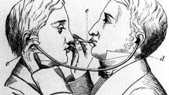 Eustachian tube catheterization with a diagnostic tube in use. From Kramer’s Aural Surgery of the Present Day (1863).
