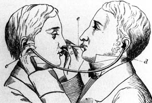Eustachian tube catheterization with a diagnostic tube in use. From Kramer’s Aural Surgery of the Present Day (1863).