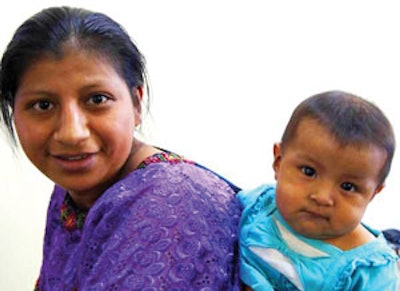 An indigenous woman waits while another of her children has his cleft palate repaired.
