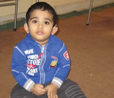 This boy had bilateral implants in Singapore and is being rehabilitated at Professor Amin’s hospital.