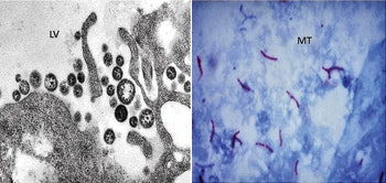 Figure 1, Micrograph Lassa Virus (LV) and Mycobacterium tuberculosis (MT).