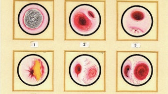 02_Jackson_Diverticulums