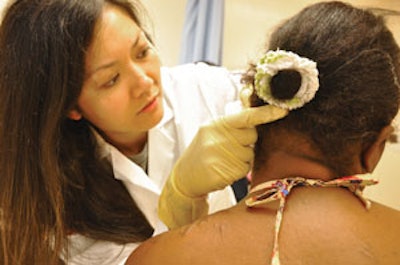 Post-operative clinic, follow-up visit for ear reconstructive surgery.