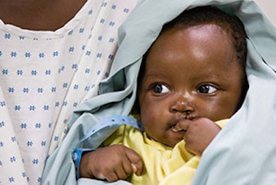 Tiny Teresia W. awaits surgery.