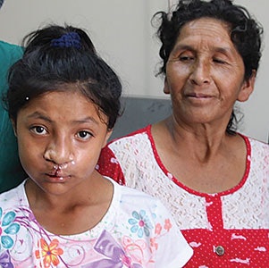 Cleft lip/palate surgery changed the outlook for this 12-year-old Peruvian patient.