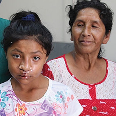 Cleft lip/palate surgery changed the outlook for this 12-year-old Peruvian patient.
