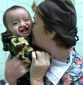Volunteer nurse, Heather Foster, playing with Luis before his lip surgery. Luis could not stop laughing.