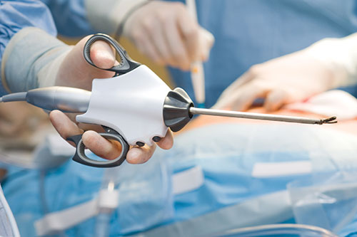 Currently, all risk classifications for devices are eligible for reprocessing, but class I and class II devices (such as harmonic scalpels, shown above) are the most commonly reprocessed devices.
