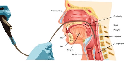 Neck Mass Figure1 Scope Exam