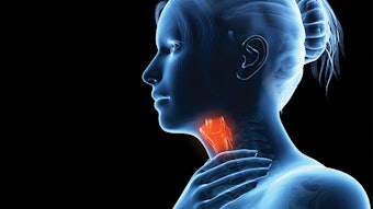 Dysphonia