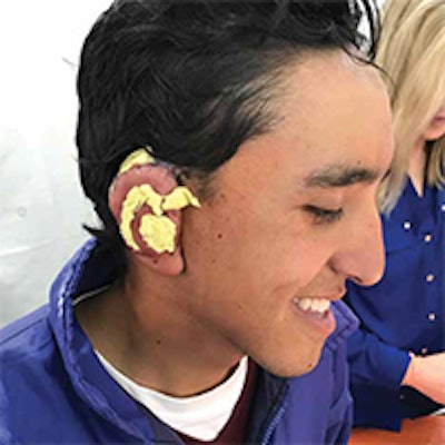 Larry had been teased for his deformity, but this mission has helped him to overcome that challenge.