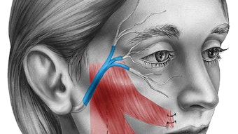 facialReinnervation