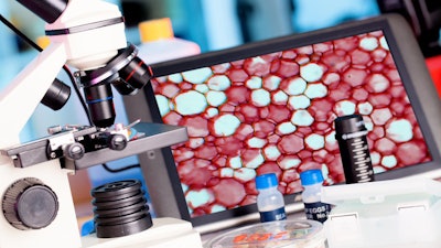 Getty Images 501138219