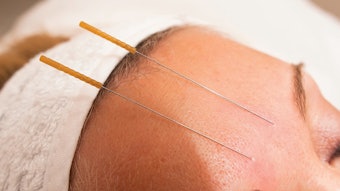 05 Accupuncture