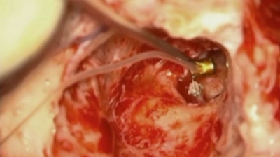 Courtesy Dr. S. Arauz