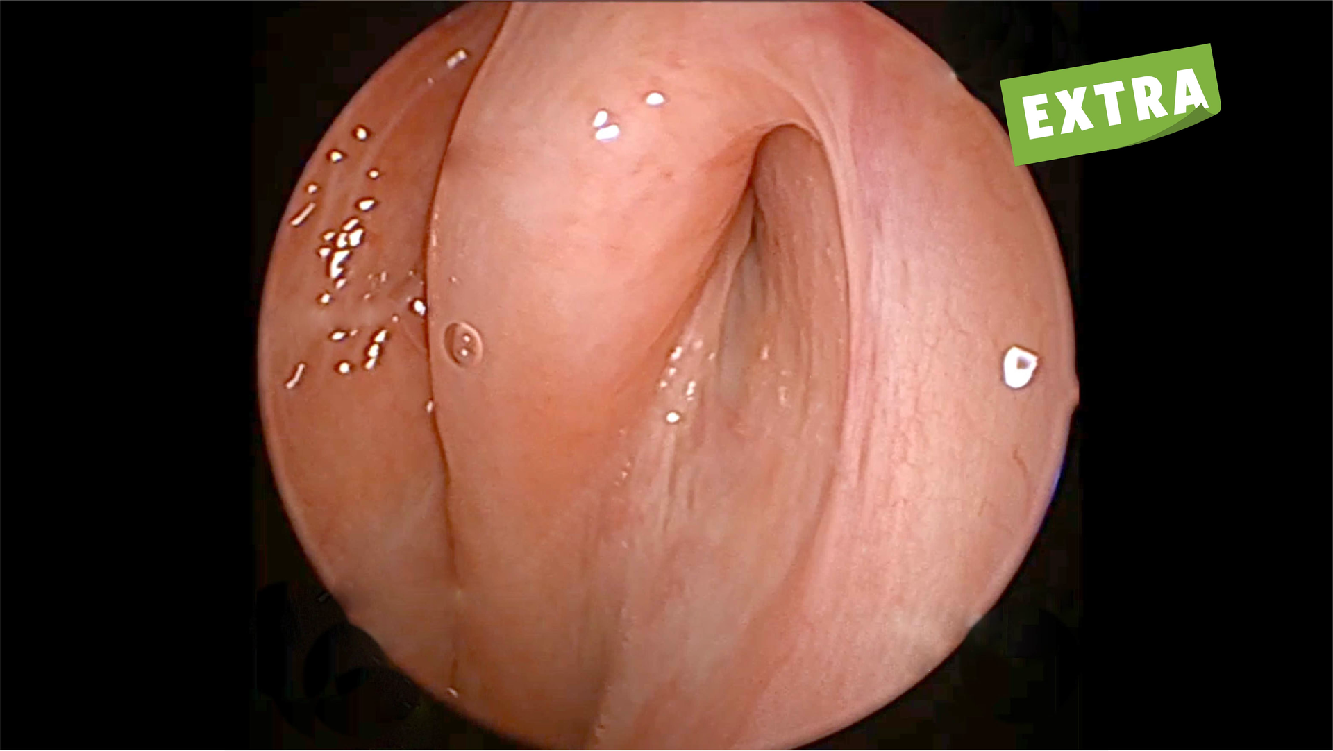 March Primary Images For Base 15