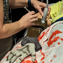 Photo of a fake zombie arm being worked on by medical professionals