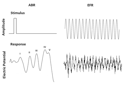 Figure 1. Comparison of typical stimuli and recorded waveforms (response) for ABR and EFR.
