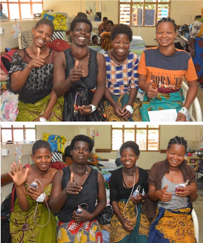 Before (top) and after (bottom) of patients in the ENT ward treated for neck masses.
