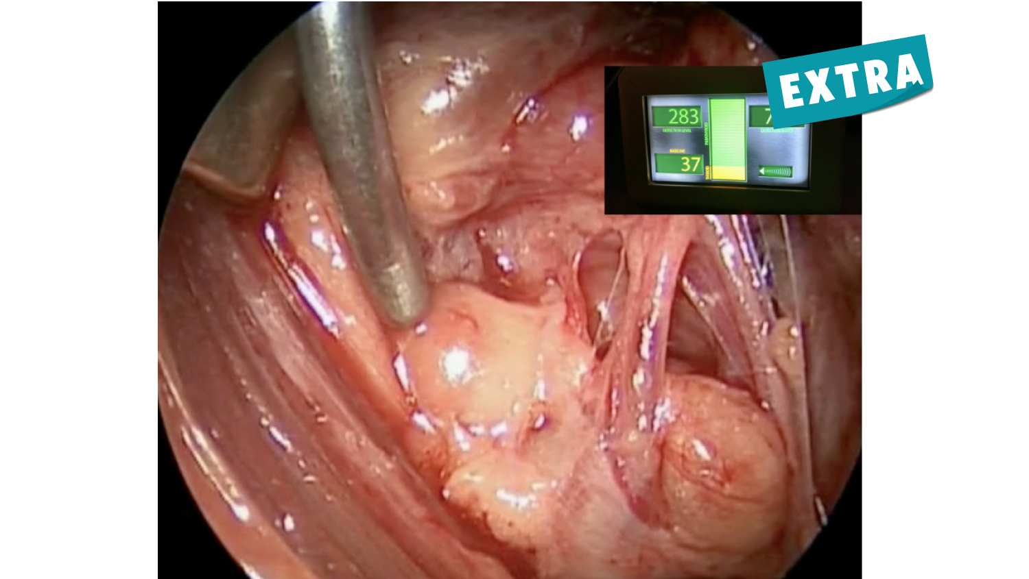 Innovative Technology For Parathyroid Gland Identification 2 Base