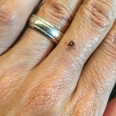 Image Credit: CW David Chang, MD