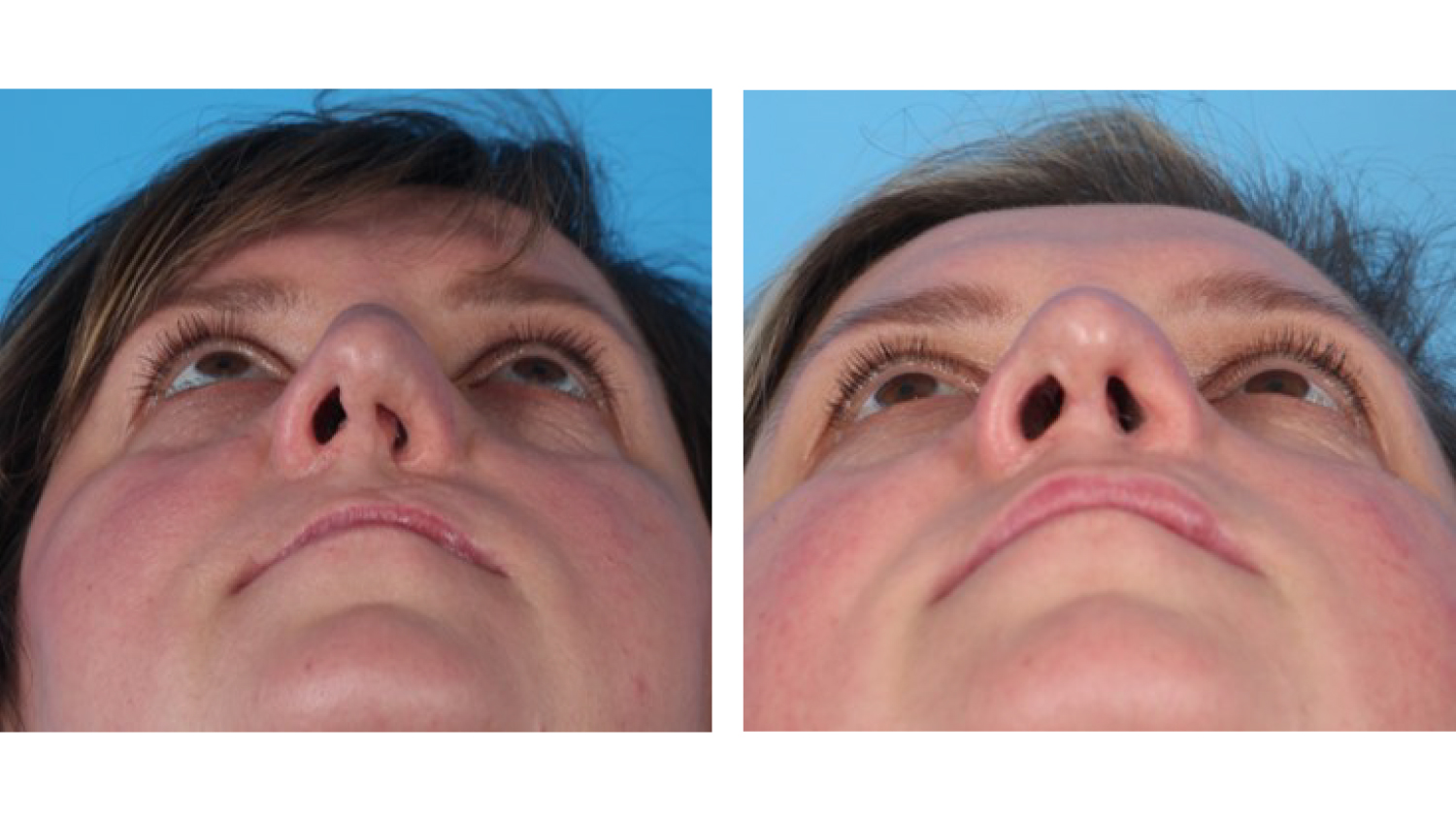 Adult Cleft Care Base