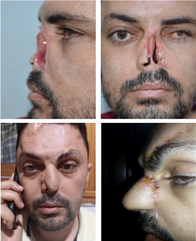 Storiesfromtheroad Collage