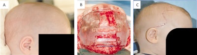 Historyof Craniofacial Figure1