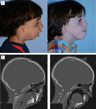 Historyof Craniofacial Figure2ab