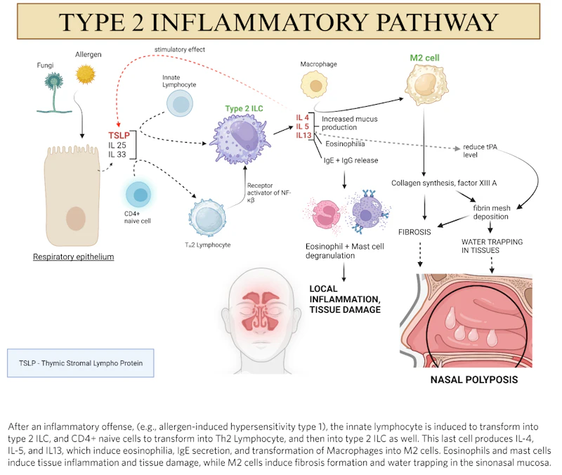 Allergic Rhinitis Polyps Biologics for Chronic Rhinosinusitis with Nasal Polyps | AAO-HNS Bulletin