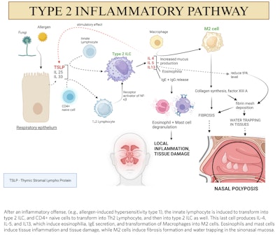 Figure 1. Pathogenesis of nasal polyps. (Figure created by Nitish Kumar, MBBS, MS, using biorender.com.)
