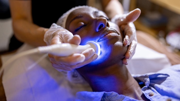 person with dark sking getting facial laser therapy