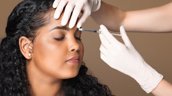 Botox Image