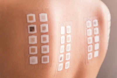 patch test on person's back