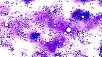 Fine Needle Aspiration