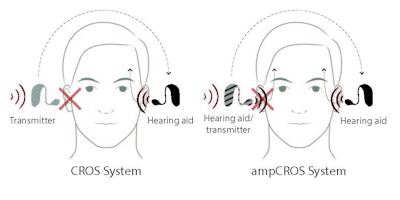 Figure 1. Contralateral routing of signal (CROS) and ampCROS amplification configurations for unilateral or asymmetrical hearing loss.