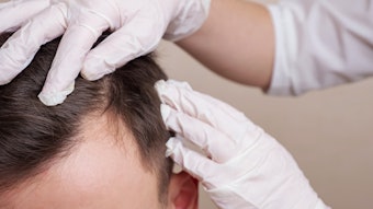 This is a photo of a gloved medical worker examining a male patient's scalp.