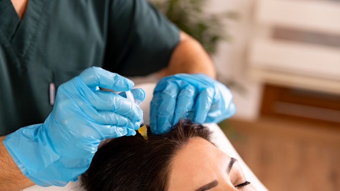 This is a photo of a female patient getting a regenerative medicine treatment on her scalp.