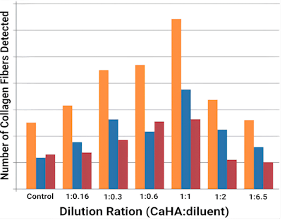 Figure 1. Dilution of CaHA to transform volume restoration into regeneration. Source: Casabona G, Plast Reconstr Surg Glob Open, 2017.