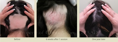 Upscaled 2x Exomes Picture1