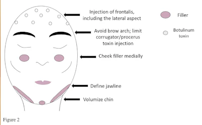 Female-to-male gender affirmation injectable example.