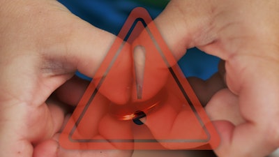 02 Button Battery 1500x845 V2