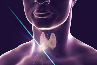 09 Thyroid Nodule Thumbnail