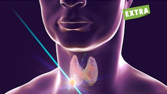 09 Thyroid Nodule Thumbnail Base