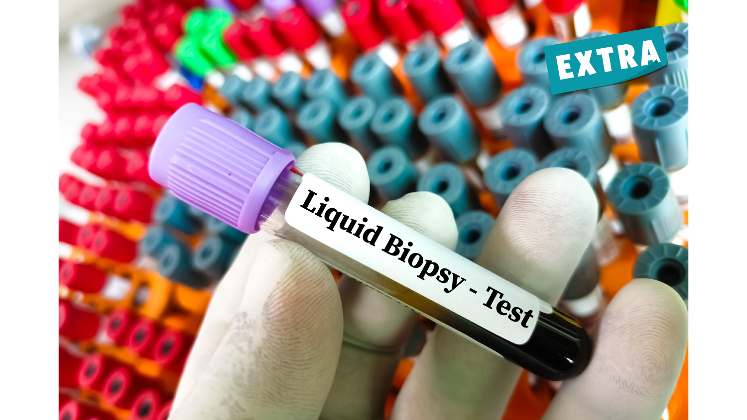 Circulating Tumor Dna Test Thumbnail Base