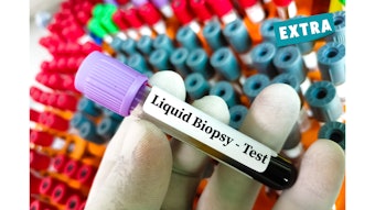 Circulating Tumor Dna Test Thumbnail Base