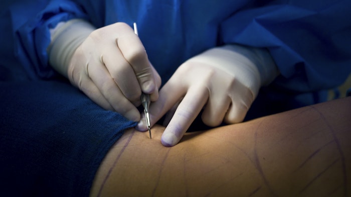 Getty Images 157383767